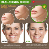 Collagen Patches – Rejuvenate, Firm & Elasticity Health Platter (30-Day Supply) - COMING SOON